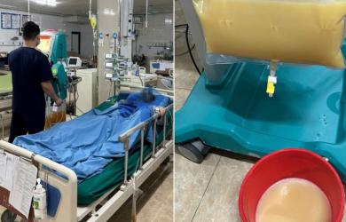 Thực hư 'trào lưu' lọc máu ngừa đột quỵ, tim mạch, bác sĩ chỉ rõ những nguy hiểm tiềm ẩn